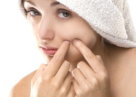 Pimple , spot on beauty woman face with a white towel