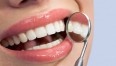 Close-up of patients healthy smile with mirror near by